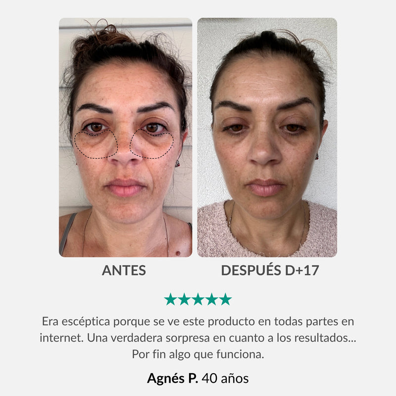 Tratamiento Integral para el Contorno de Ojos : Lapiz & Sérum Activador