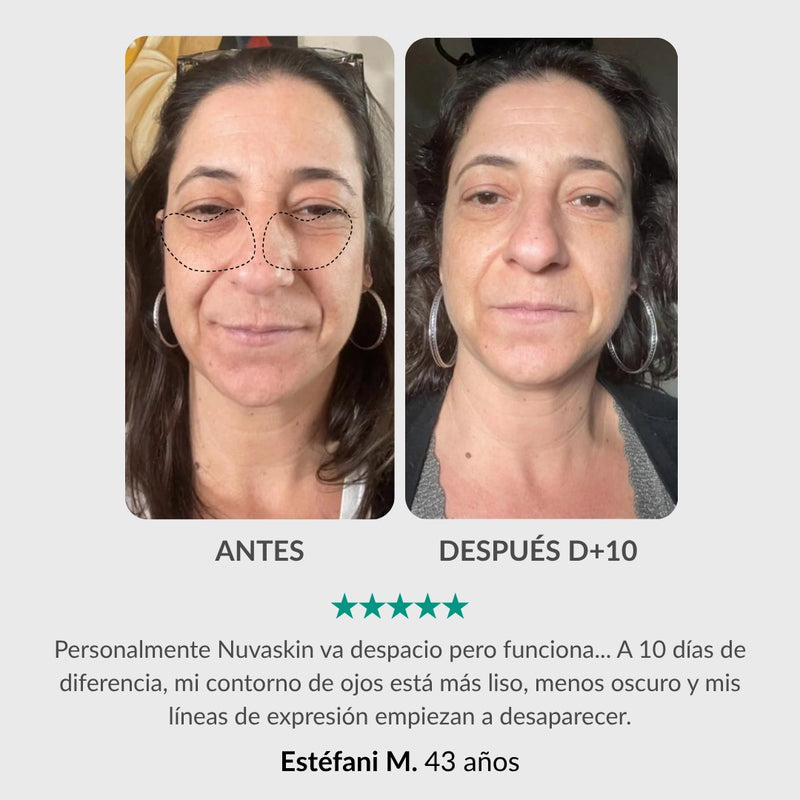Tratamiento Integral para el Contorno de Ojos : Lapiz & Sérum Activador
