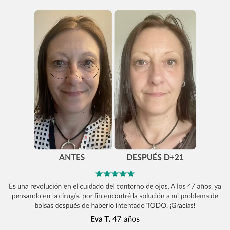 Tratamiento Integral para el Contorno de Ojos : Lapiz & Sérum Activador